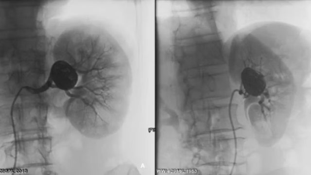 Clinical Cases on Peripheral Interventions