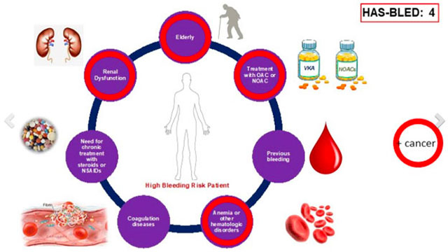 Complex heart problems in cancer patients