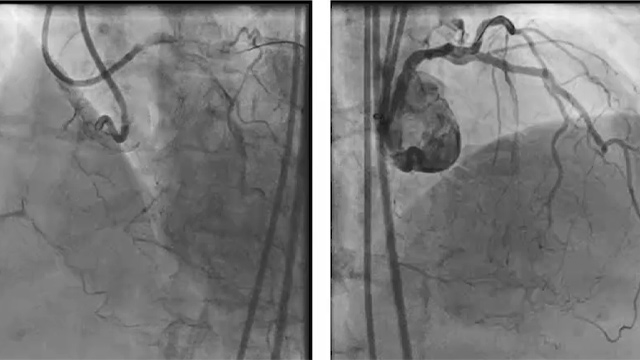 CTO interventions outcomes