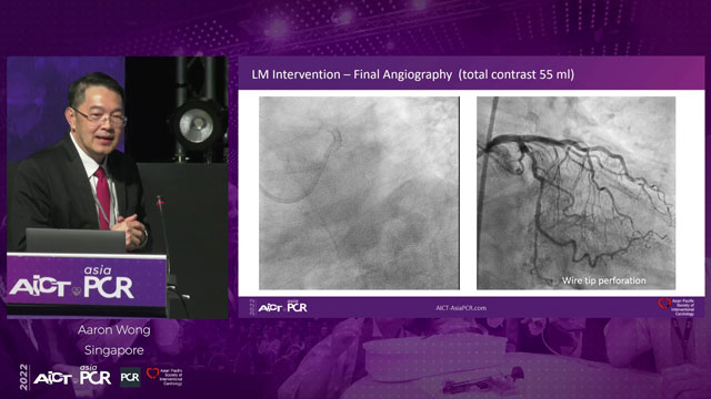 Evolving approaches to planning and guiding of complex PCI with ultra-low contrast