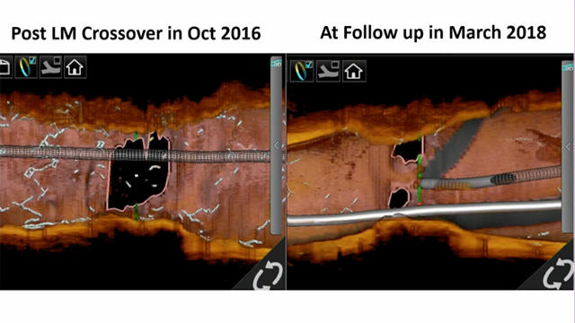 How should I treat ostial circumflex restenosis?