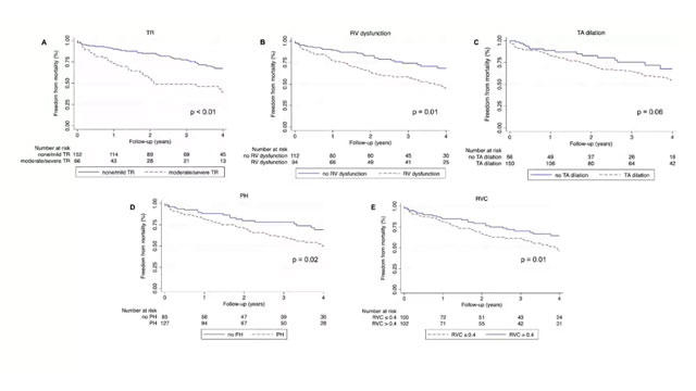 Imaging for tricuspid valve interventions