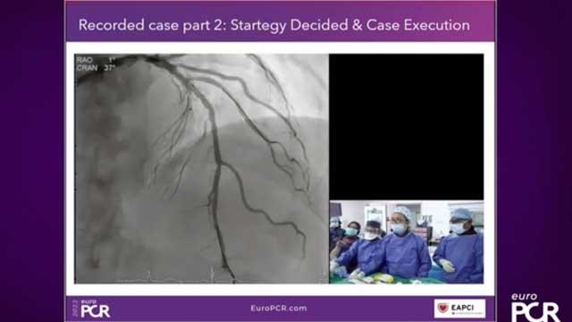 Is DK Crush the optimal two-stent bifurcation strategy for left main PCI?