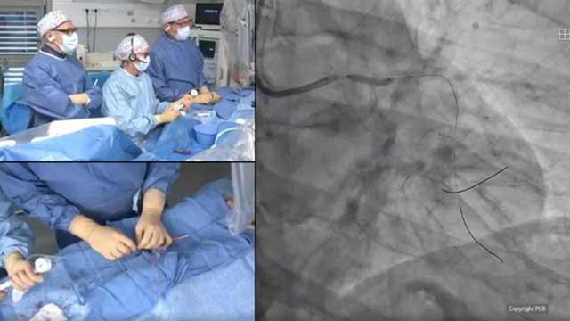 Left main and complex bifurcation PCI in high bleeding risk patients