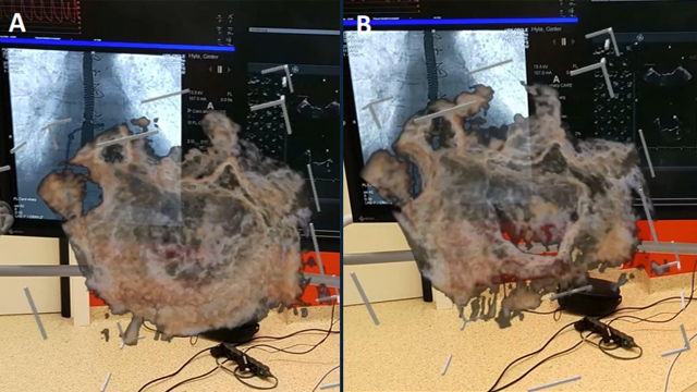 Mitral innovations