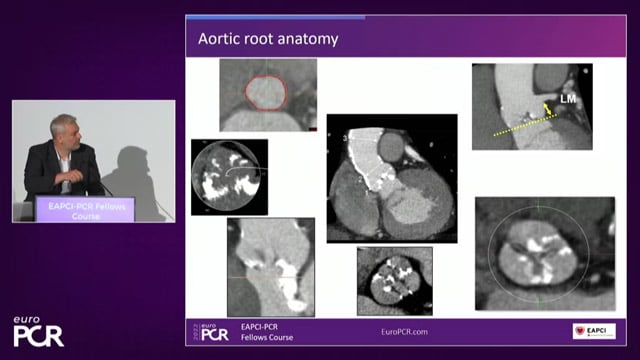 Our patient with aortic stenosis