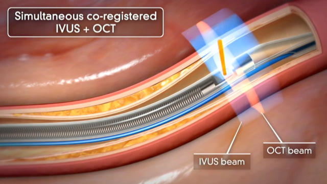 PCR Innovators Day - innovations in imaging and physiology