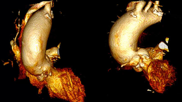 Rapid-fire clinical cases: session 2