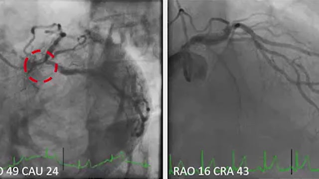 Stable PCI: be careful with the wire