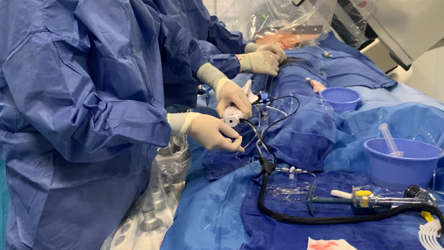 The why and how of performing plaque modification in calcified lesions