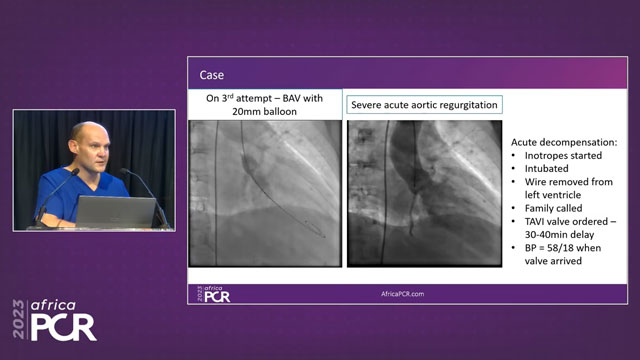 Valvular clinical cases