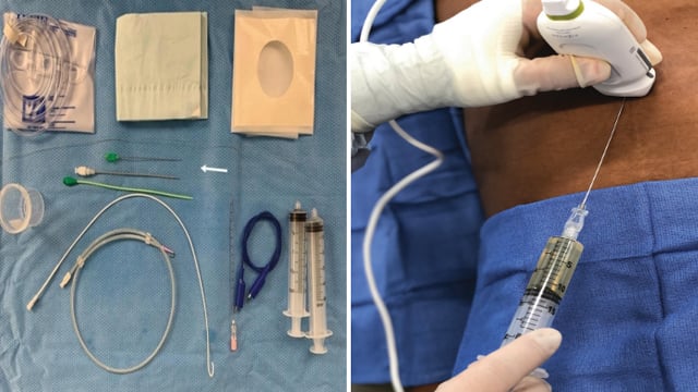 Management of cathlab disaster