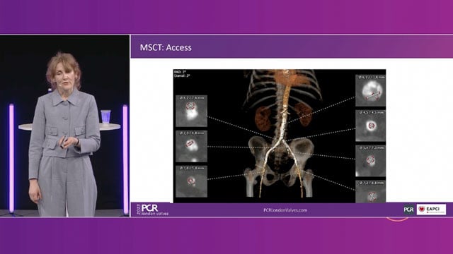 Challenging TAVI cases
