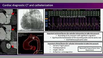 Aortic complications