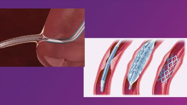 Cathlab: different issues