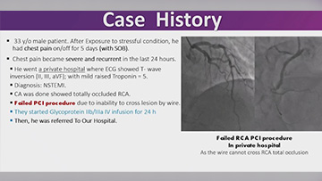 STEMI in young patients