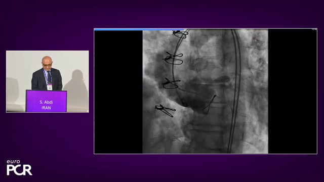 Complex scenarios in TAVI