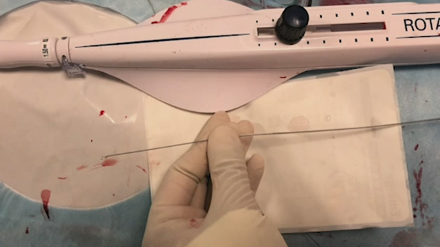 Complications in the treatment of calcified lesions