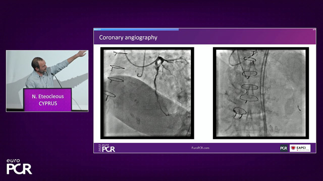 CTO challenging cases
