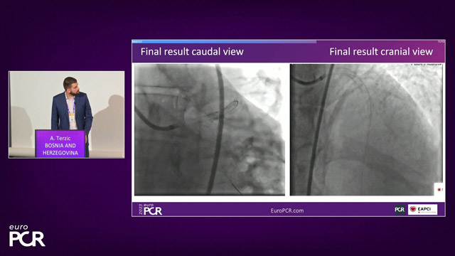 How should I treat - Complex coronary cases