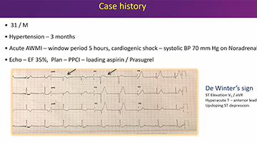 Left main and STEMI cases