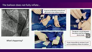 Miscellaneous complications of TAVI