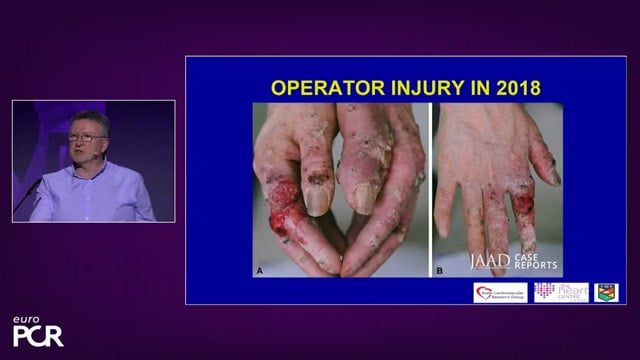 Radiation and our professions