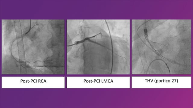 Shock with valve disease - Part 2