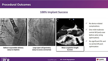 TAVI - Abtract slides