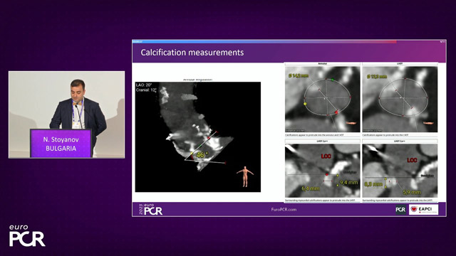 TAVI in heavily calcified aortic disease