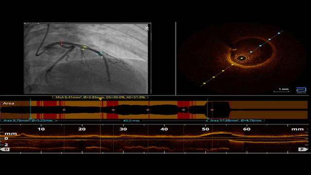 Working in the cathlab makes everyday different
