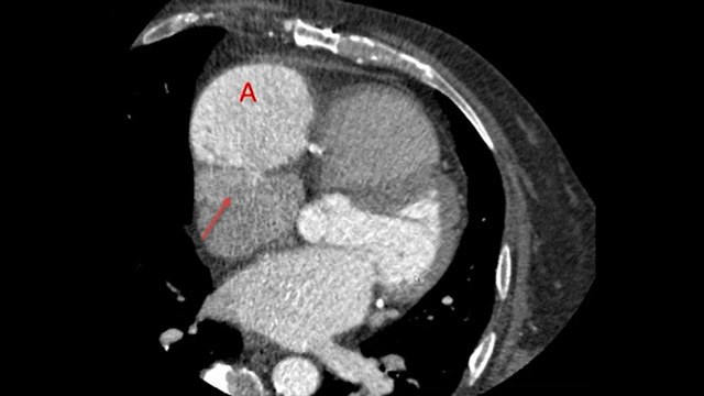 Challenging cases – Best case submissions