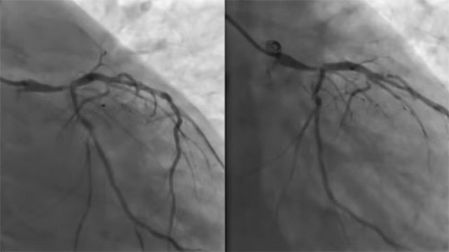 Challenging scenarios in cardiogenic shock