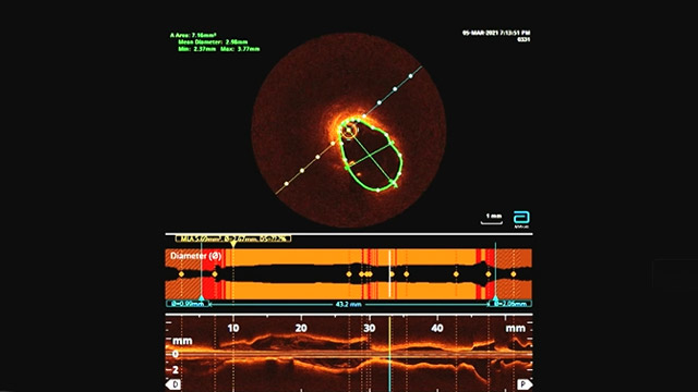 How should I treat my female patients?