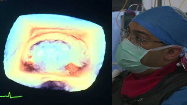 Latest developments in interventional valve therapies
