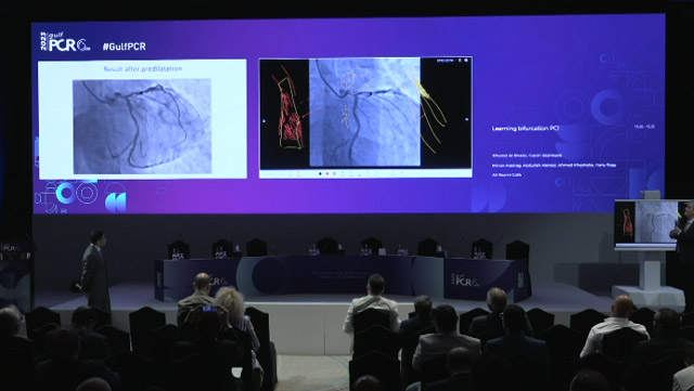 Learning bifurcation PCI
