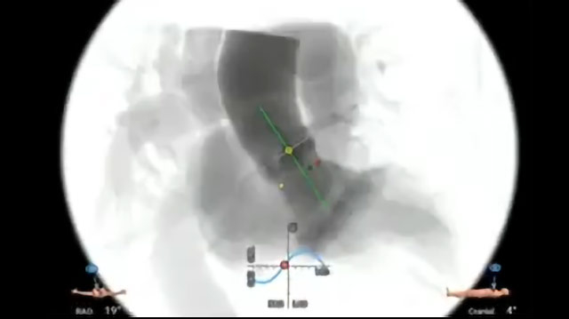 Essentials of lifetime management of TAVI patients