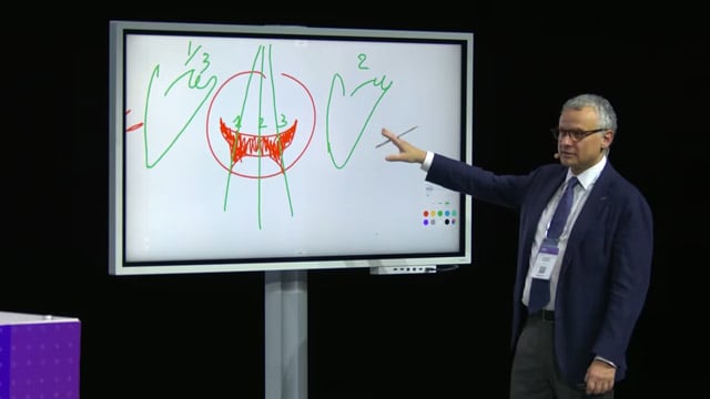 Key questions in mitral TEER - what do I need to know to do the procedure safely?