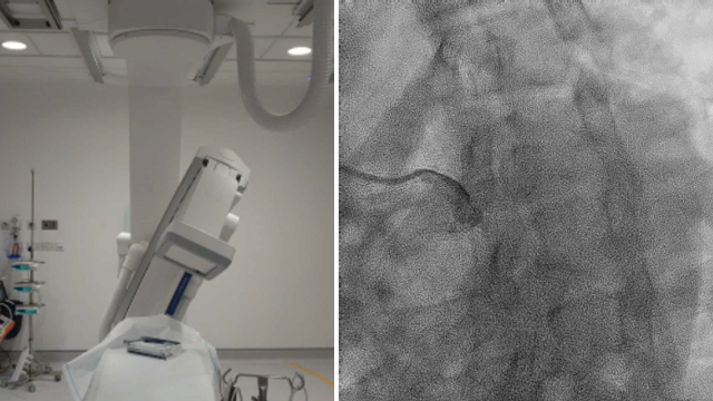 Advancements in the cathlab: innovations and insights from nurses and allied professionals