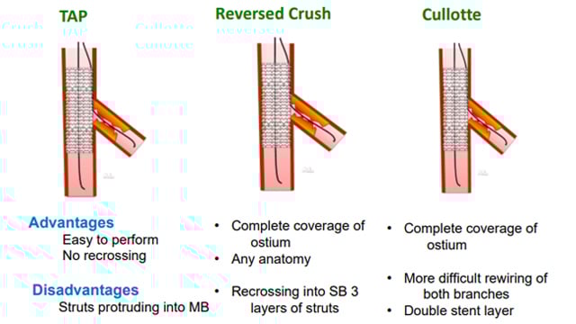 All you need to know on left main bifurcations