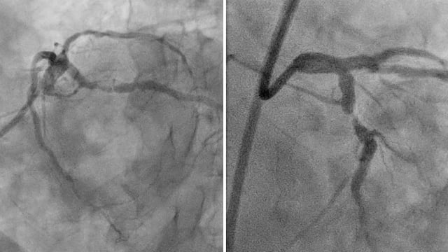 Resorbable magnesium scaffolds - Unveiling the future