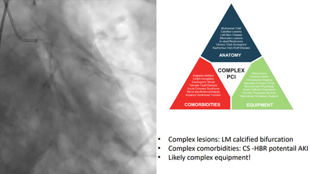 Tips and tricks for left main PCI