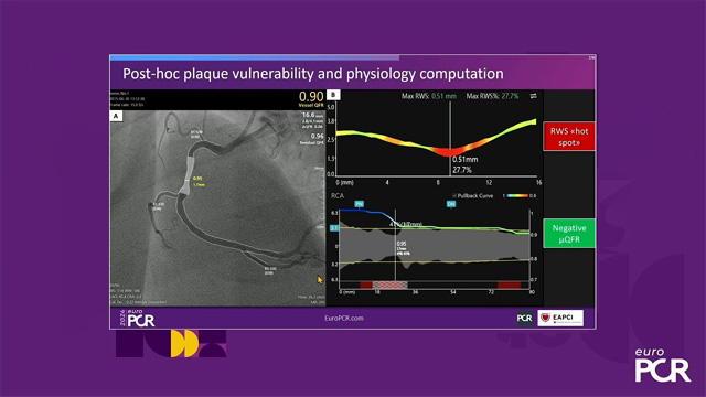Artificial intelligence-powered quantification of coronary physiology and vulnerable plaque: opportunities for novel treatment options