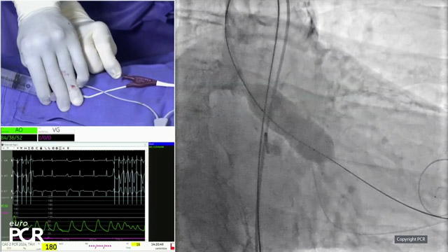 Align for the future with next-generation balloon expandable transcatheter heart valve technology
