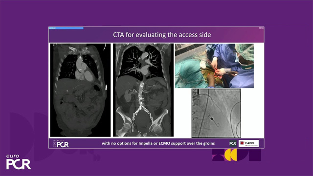 The complexity in treatment of patients in shock