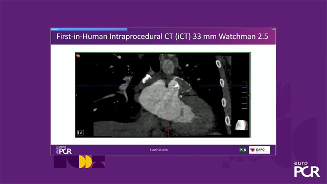 The future of interventional cardiology imaging