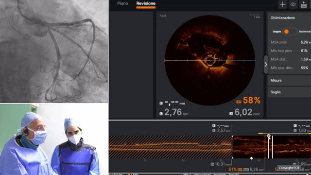 Imaging-guided left main PCI