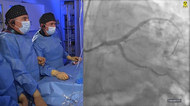 Management of patient with complex left main stenosis - LIVE case