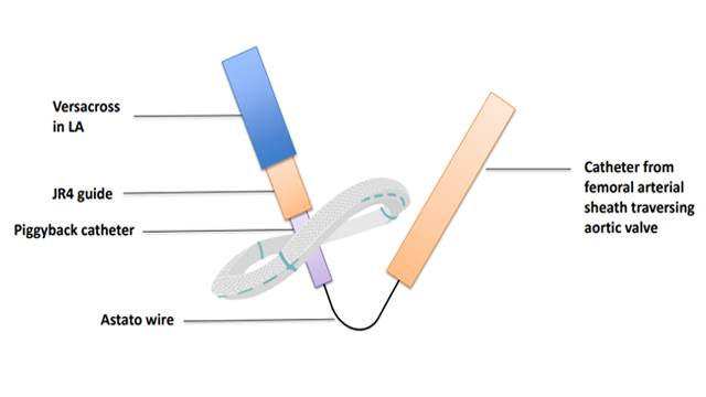 Mitral valve replacement devices and techniques