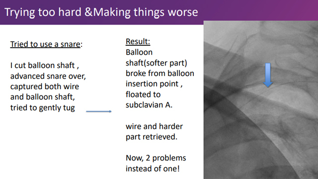 PCI complications: device-related issues, perforations and other unexpected events